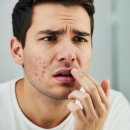 입술 헤르페스 초기 증상과 원인, 헤르페스 1형 전염 및 치료 방법 이미지