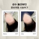 성수 헤어라인커버 자연스러운 붉은잔흔 커버 올라뷰티 내돈내산(리터치 O)