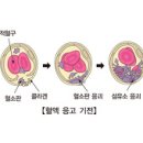 폐색전증 관련 SWF이지만 호흡 메카니즘 이해에 도움이 될 듯하여 올립니다. 이미지