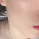 트리메드 이미지