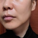 차밍인셀덤 | 내돈내산 후기-인셀덤3주차