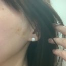 청담디어의원 | 청담디어의원 실리프팅 후기 ˗ˋ ୨୧ ˊ˗ ✊🏻 ̖́-