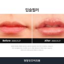 잇츠미의원 네이버블로그