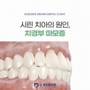 수성드림치과 이미지