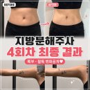 오니트(주) | 부산지방분해주사 4회차 내돈내산후기 팔뚝·복부 전후 비교결과