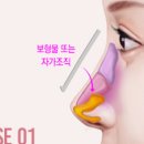 에스클래스성형외과의원 이미지