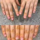 언제나,예쁘다 | 광주 초등학생 물어뜯는손톱 교정 | 손예쁘다