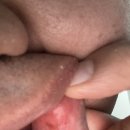 우암치과 | 구강작열감 치료후기