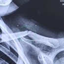 화정본정형외과의원 이미지