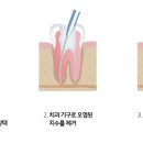효치과 이미지