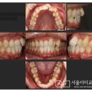 하모니치과의원 | [인천교정치과] 아이 교정하러 왔다가 아빠도 시작했어요, 성인남성치아교정 (서울아미교정치과)