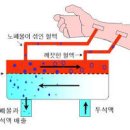 투석 유형 복막투석 혈액투석 투석을 하는 이유 복막투석에 좋은 음식 이미지