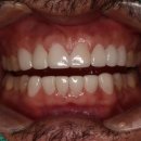 서울가족치과기공소 이미지