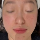 신사커스텀 | 신사역 에이브의원✨ 피부 탄력 커스텀토닝 솔직후기