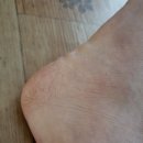 하이메디 | 하이메디 힐패드 뒤꿈치양말 내돈내산 후기