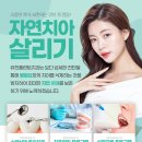 유천플란트치과 이미지