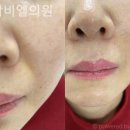 청담비엘의원 이미지