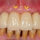 가온치과기공소 이미지