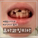 안양7동-2 | 7세 유아 과잉치아 2개 발치하기까지 기록