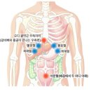 오디한의원 | 담적증(오디괄약근의 기능 부전)