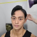코비한의원 | 남자 얼굴 볼륨 앞광대 볼륨 코비한의원마포점 약침 후기 1 약침 맞고 1일차