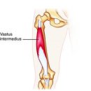 vastus intermedius 이미지