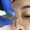 수원-1331 | 수원왁싱 잘하는곳 달달뷰티 슈가왁싱에서 풀페이스왁싱 받고 온 후기