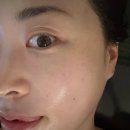리프팅잘하는 곳 파주운정리프팅 에스테틱추천 올아름에스테틱 해올점 하이푸리프팅 후기