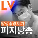 엘브이의원 | 부산피지낭종 제거 고민 중이라면 미리 확인해보셔요