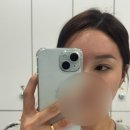 강남벨라의원 | 본식전 신논현역에서 가까운 강남벨라의원 유튜브 닥터지은원장님께 직접 상담받은 후기