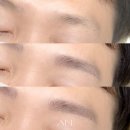 아인 메디칼 이미지