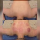 녹주맥반석찜질방 | 남양주 마석 다이어트 쉽게 녹주 찜질방 다온 마사지남양주센타 후기