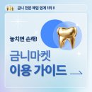 부산시청우체국 | 1g 당 금니가격 높은 온라인 금니매입업체~!
