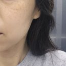 평촌프라자 | 평촌피부관리 브라이트닝 후기 아이블링 안양평촌점