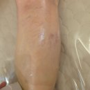 신데렐라만들기 | 신데렐라만들기 피부관리 다리 고민에 맞춰 세심하게 관리받은 후기
