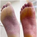 오로제주 | 제주 문제성발관리 유벨리네일 오로지푸스 제주시청점 솔직 후기