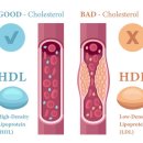 고지혈증의 이해와 관리 이미지