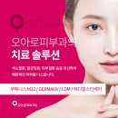 안면가스 이미지