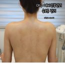 대구 예비신부관리 승모근관리 수성구 김현정에스테틱