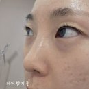 노원역 속눈썹펌, 프리미엄 케라틴펌으로 유지력 최강! 눈의숲 속눈썹펌 후기
