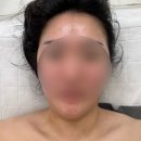 에스테티아사창 | 청주 윤곽관리 추천, 에스테티아 사창점 솔직 후기