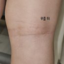 희복 | 아토피 마지막 대학병원 진료후기- 치료종료!