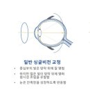 유일렌즈 이미지