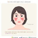 시흥간병인 이미지