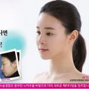 Re:사각턱 보톡스 가격문의요 이미지