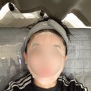 마리치과의원 | 청라V의원V피부과)스킨보톡스 리얼 독한후기,당근 내돈내산임 입아픔