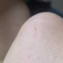 이편한덴탈랩 | 주차편한 천안시청앞 피부샵 티아뷰티랩 불당점 방문 후기 ::