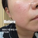 대안슈퍼 | 바이탈뷰티 슈퍼레티놀 후기｜먹는레티놀 효과가 궁금하신분, 3개월 체험담 공유해요!