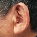 두드림 보청기 이미지