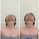 기업도시3로 | 원주 피부관리 잘하는곳 뷰티온 기업도시점 두개골 비대칭 관리 후기